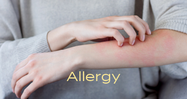 アレルギー科のイメージ写真